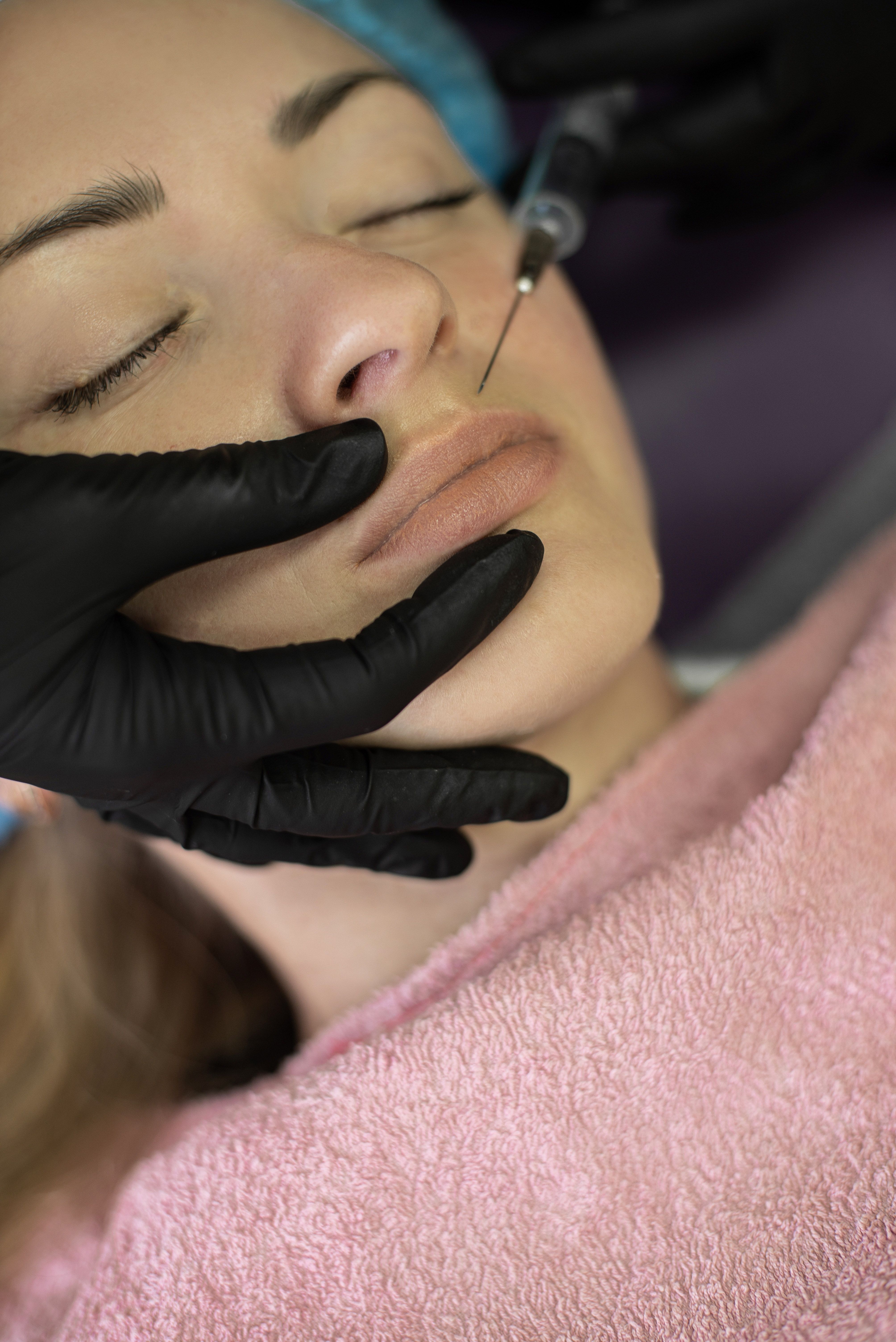 Preenchimento Labial & Mento — tratamento estético com Suéllen Yamaoka